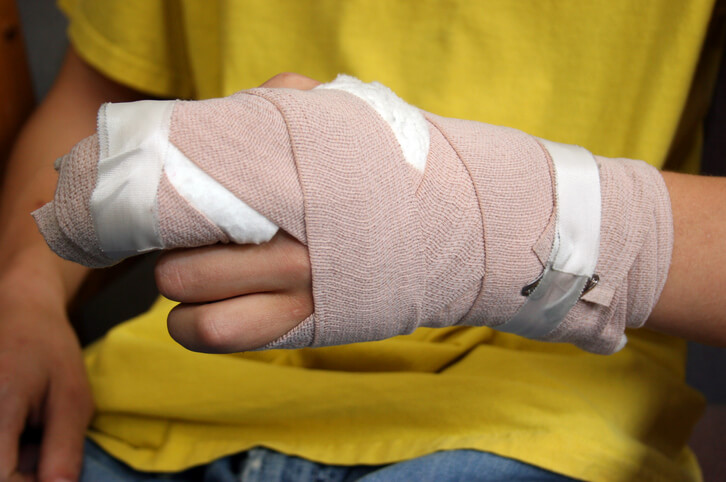Young burn victim