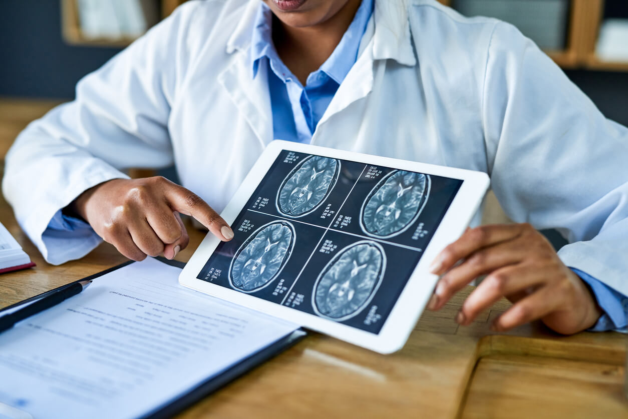 Doctor holding brain scans